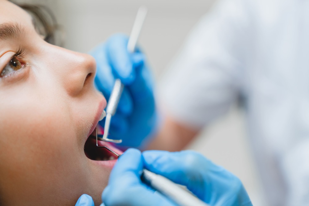 Operating Teeth Filling Mouth Cavity Against Cari Utc