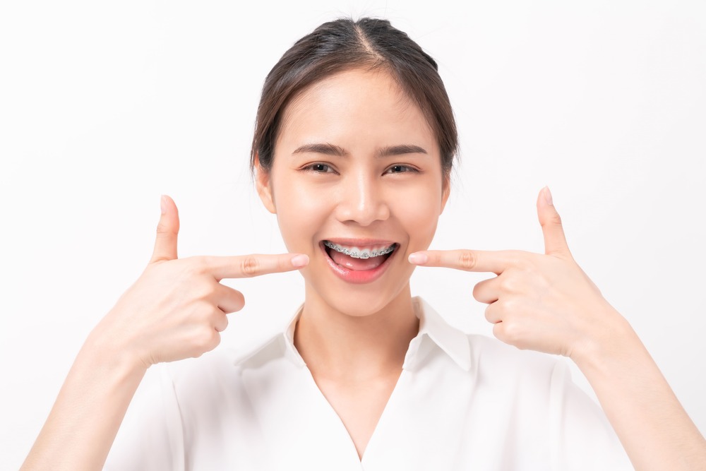 face-of-a-young-smiling-asian-woman-with-braces-on-2022-11-10-08-17-49-utc (2)