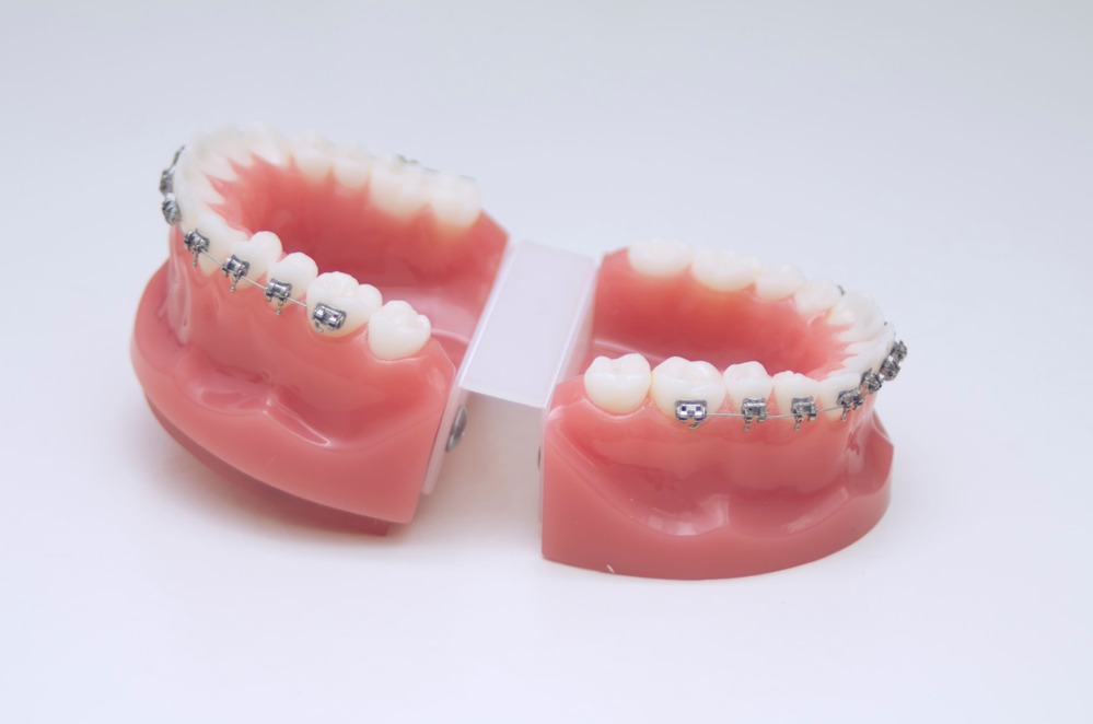 teeth-2022-11-15-23-14-12-utc (3) (1)