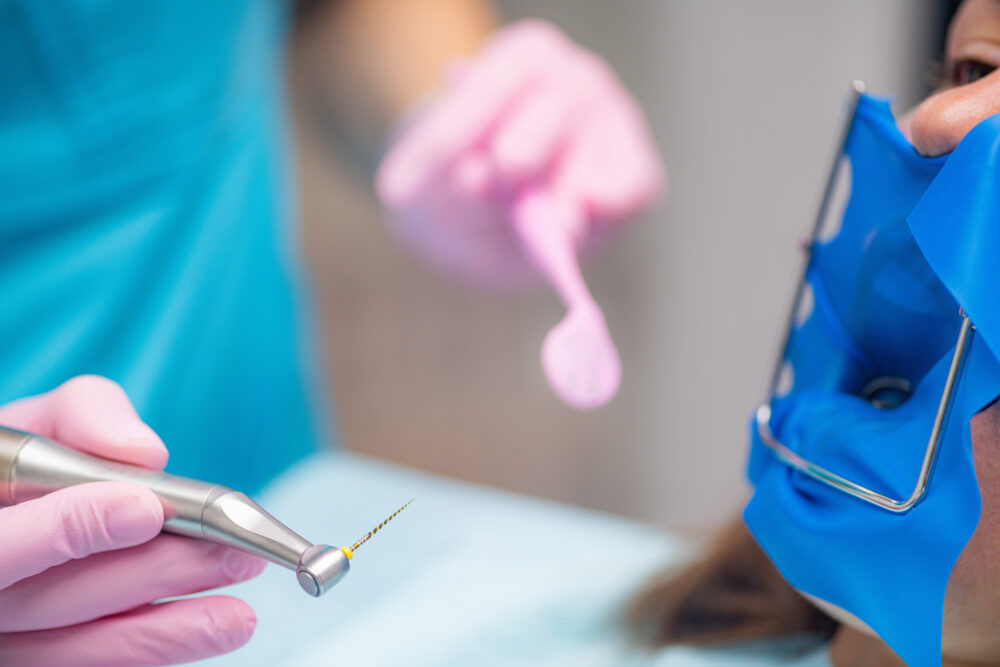 Root Canal Treatment. An Endodontist Preparing Patient for Root Canal Treatment.