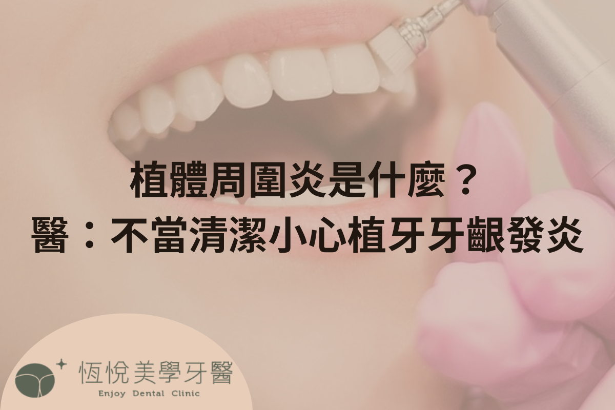植體周圍炎是什麼？醫：不當清潔小心植牙牙齦發炎