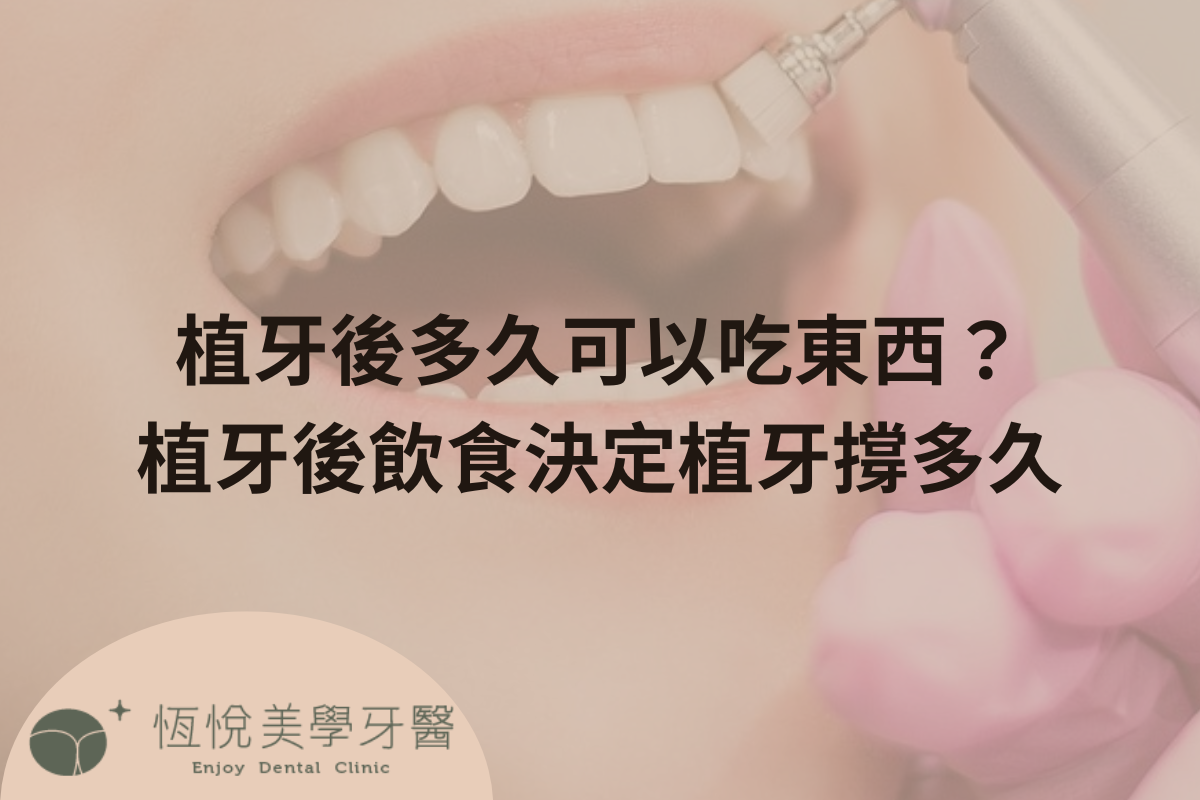 Read more about the article 植牙後多久可以吃東西？植牙後飲食決定植牙撐多久