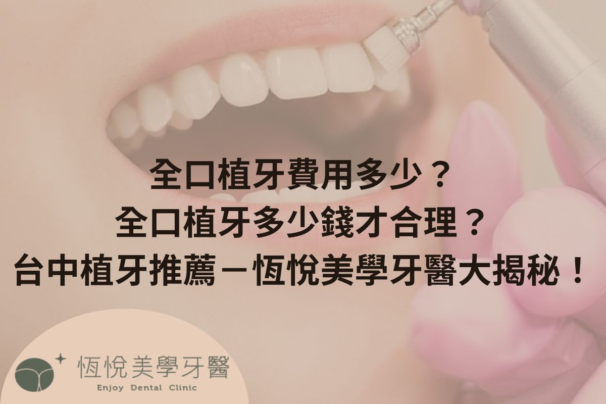 Read more about the article 全口植牙費用多少？全口植牙多少錢才合理？台中植牙推薦－恆悅美學牙醫大揭秘！