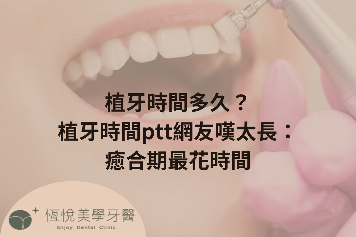 Read more about the article 植牙時間多久？植牙時間ptt網友嘆太長：癒合期最花時間