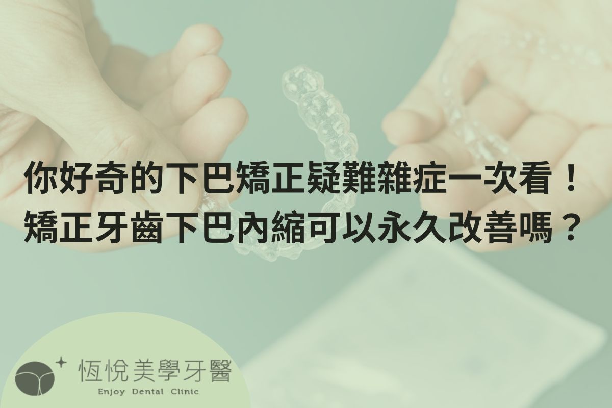 補骨粉不能省，醫：忽略補骨恐釀植牙失敗 (5)