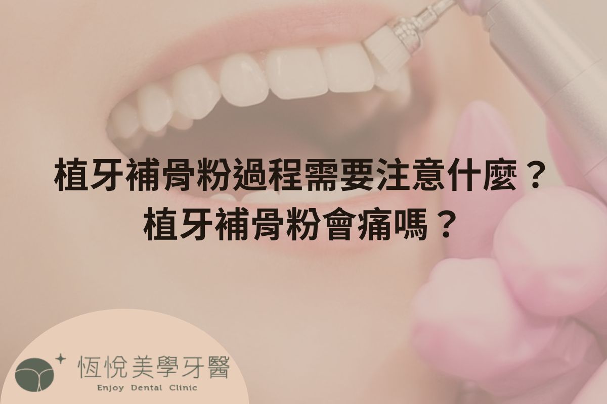 Read more about the article 植牙補骨粉過程需要注意什麼？植牙補骨粉會痛嗎？