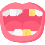 bad teeth 2