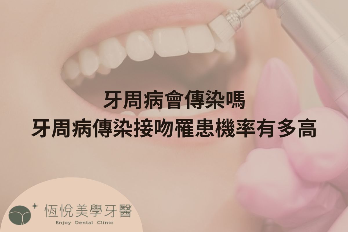 Read more about the article 牙周病會傳染嗎？牙周病傳染接吻罹患機率有多高？