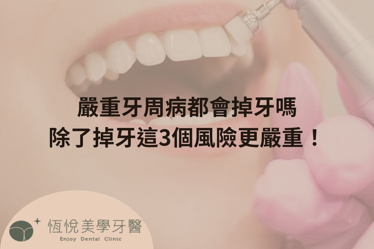 Read more about the article 嚴重牙周病都會掉牙嗎？除了掉牙這3個風險更嚴重！