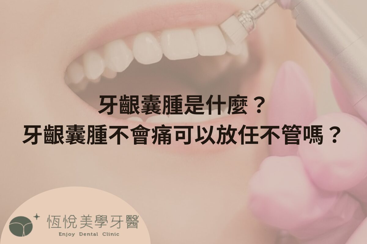 Read more about the article 牙齦囊腫是什麼？牙齦囊腫不會痛可以放任不管嗎？