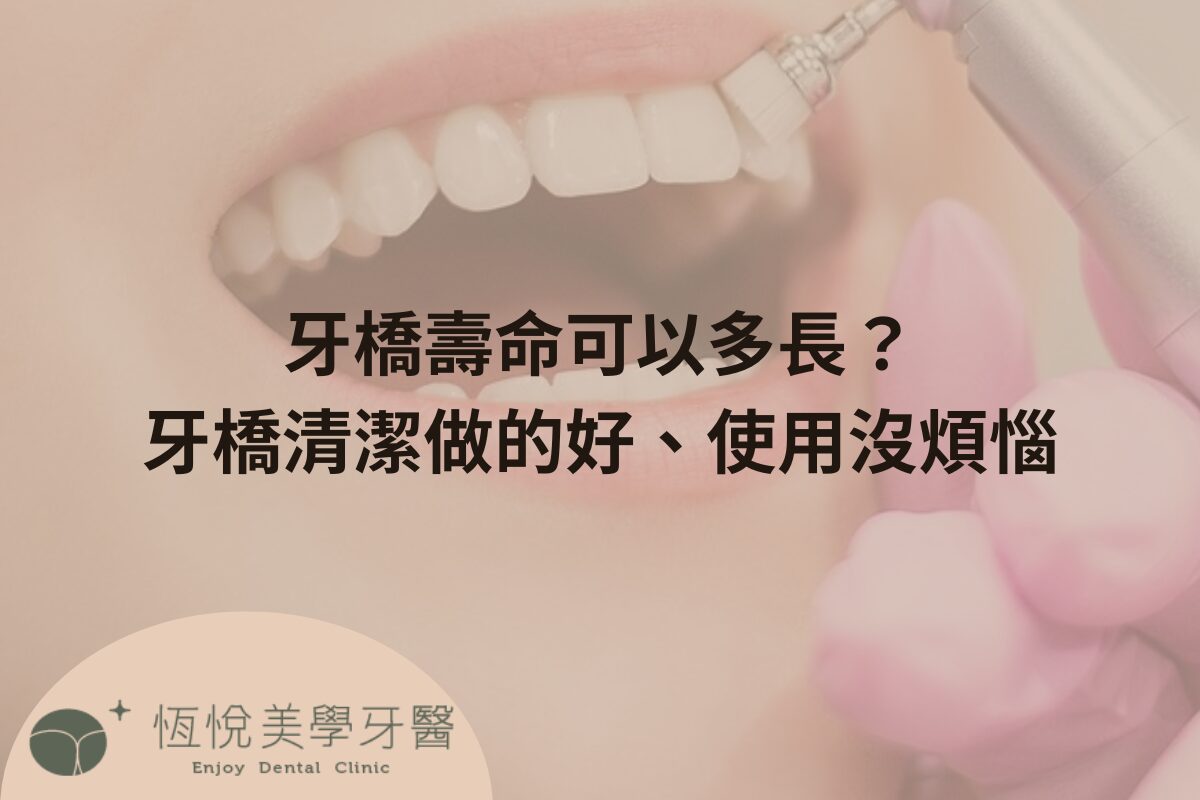 Read more about the article 牙橋壽命可以多長？牙橋清潔做的好、使用沒煩惱