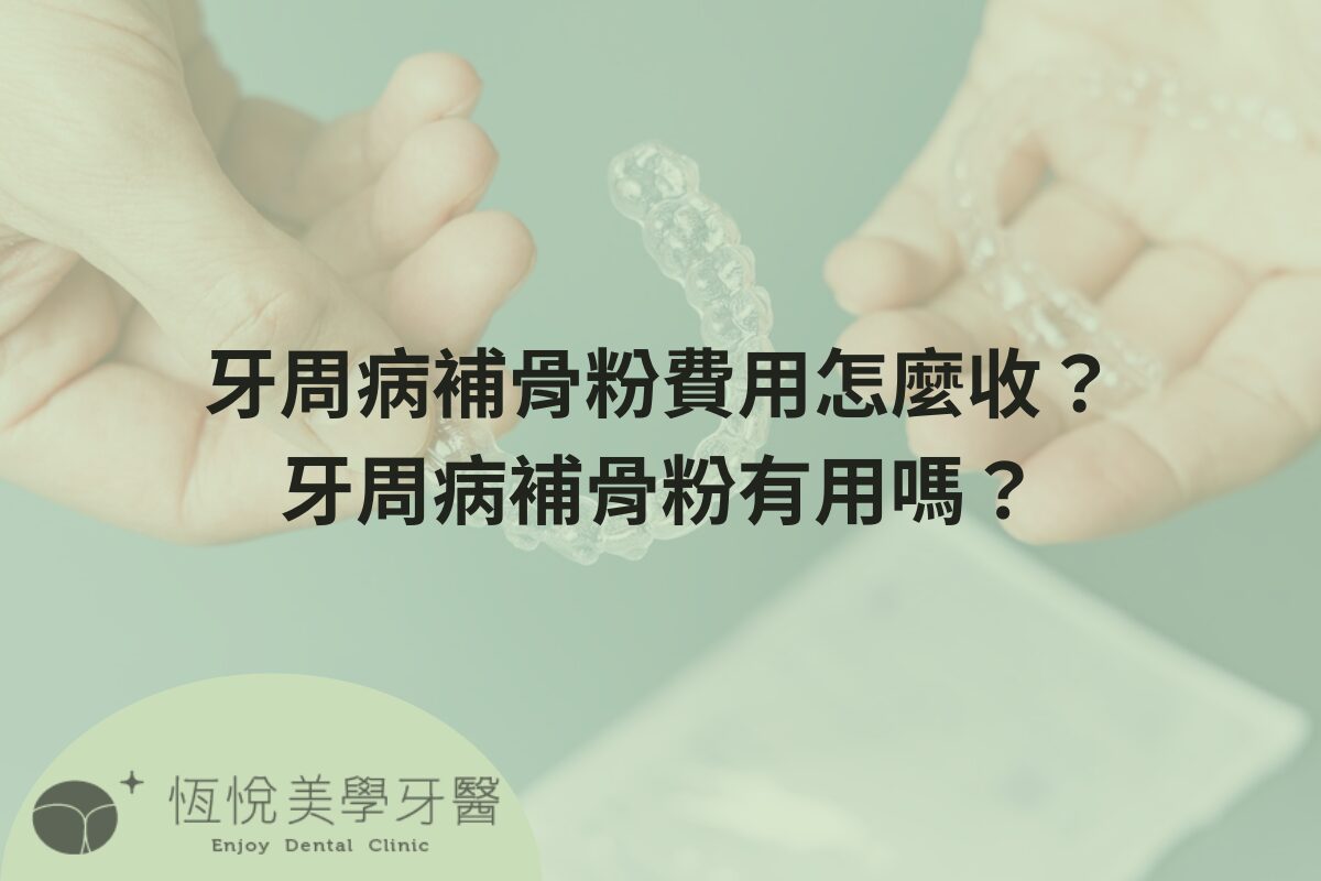 Read more about the article 牙周病補骨粉費用怎麼收？牙周病補骨粉有用嗎？