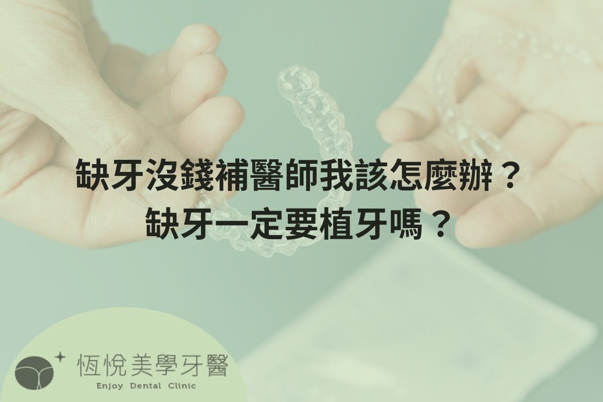 Read more about the article 缺牙沒錢補醫師我該怎麼辦？缺牙一定要植牙嗎？