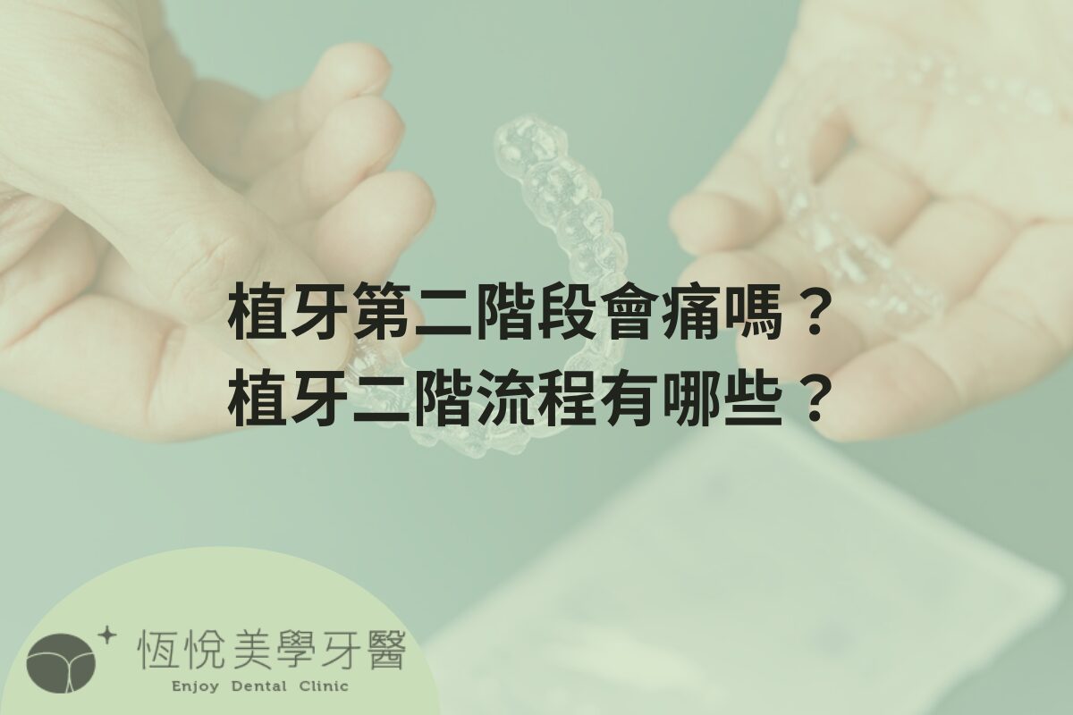 Read more about the article 植牙第二階段會痛嗎？植牙二階流程有哪些？