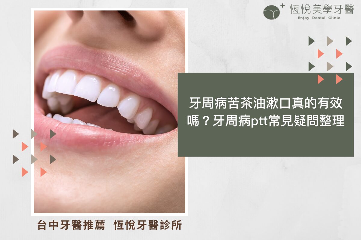 Read more about the article 牙周病苦茶油漱口真的有效嗎？牙周病ptt常見疑問整理