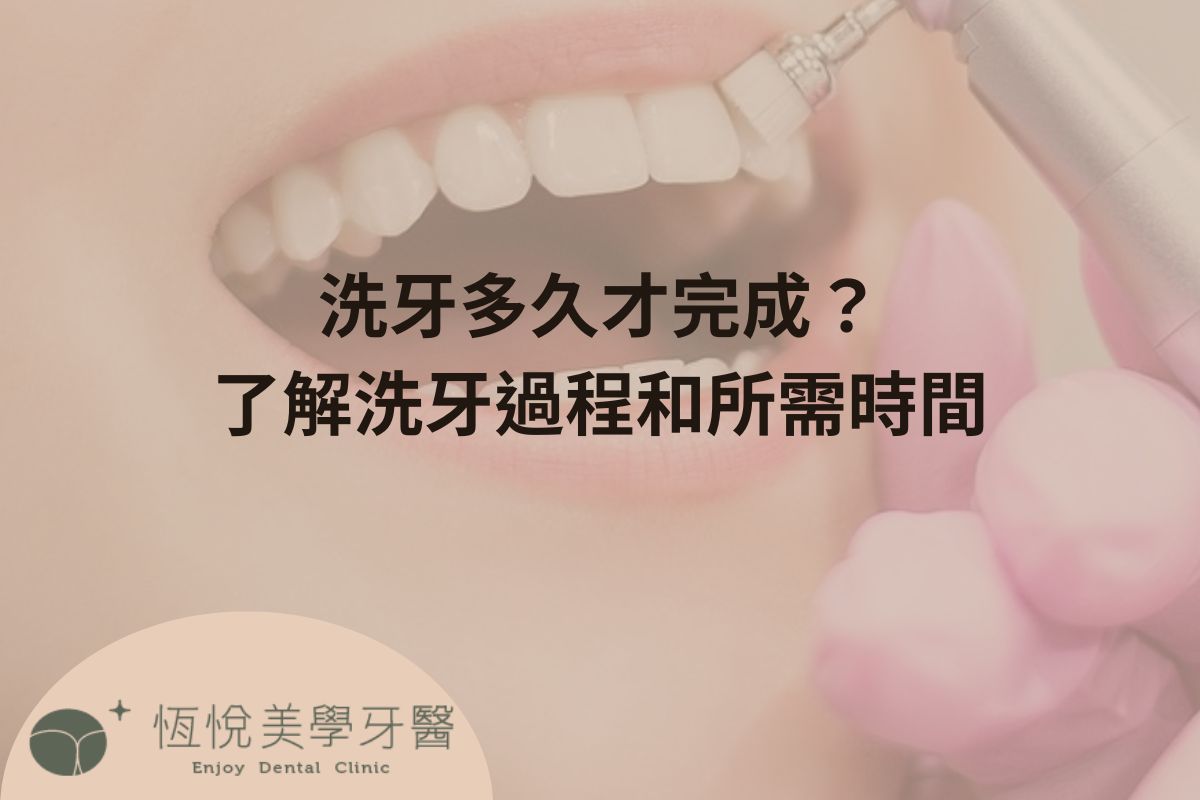 Read more about the article 洗牙多久才完成？了解洗牙過程和所需時間