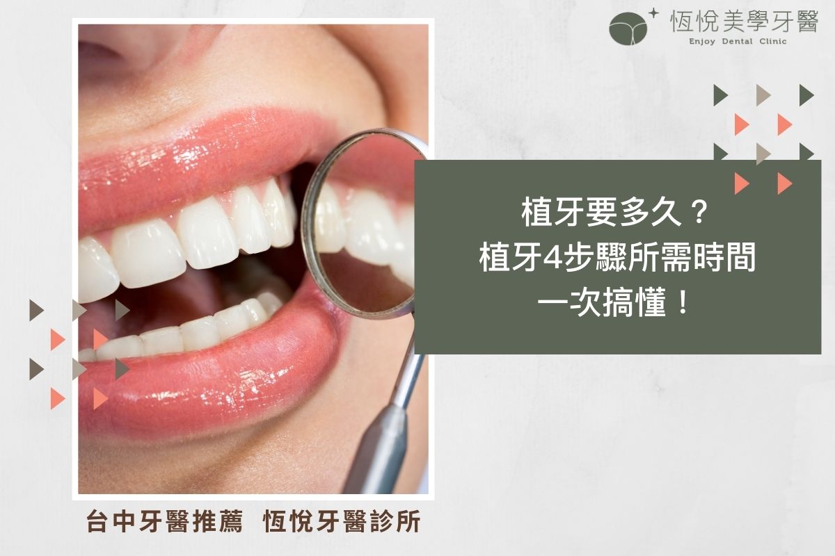 Read more about the article 植牙要多久？植牙4步驟所需時間一次搞懂！