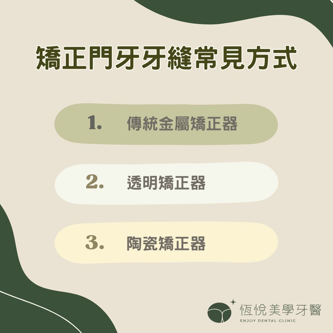 矯正門牙牙縫常見方式