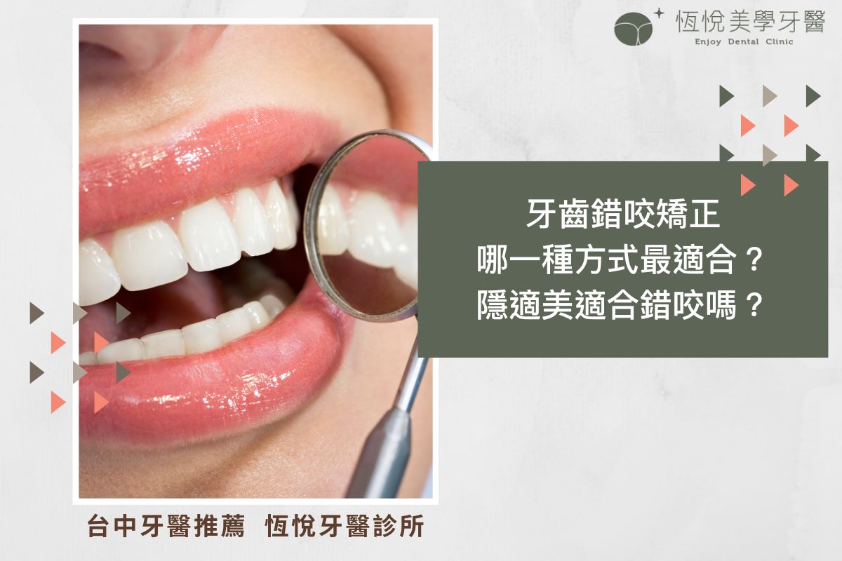 Read more about the article 牙齒錯咬矯正哪一種方式最適合？隱適美適合錯咬嗎？
