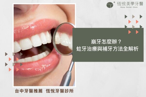 崩牙怎麼辦？ 蛀牙治療與補牙方法全解析