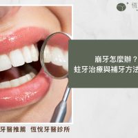 崩牙怎麼辦？ 蛀牙治療與補牙方法全解析