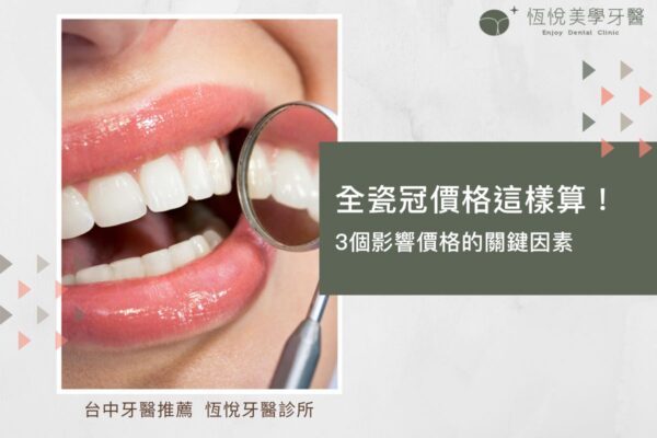 全瓷冠價格這樣算！3個影響價格的關鍵因素
