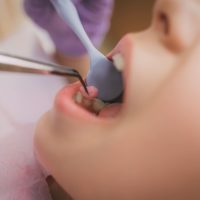at-the-dentist-2021-08-26-22-28-13-utc (1) (1)