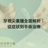 comprehensive-analysis-of-tooth-apical-cyst