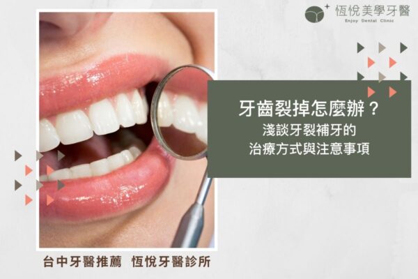 牙齒裂掉怎麼辦？ 淺談牙裂補牙的治療方式與注意事項