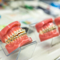 Dental, medicine equipment, orthodontic. Dentist cabinet, stomatology Tooth care mouth hygiene