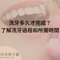 洗牙多久才完成？了解洗牙過程和所需時間