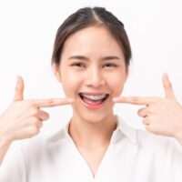 face-of-a-young-smiling-asian-woman-with-braces-on-2022-11-10-08-17-49-utc (2)