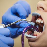 for-the-most-beautiful-teeth-2022-04-06-04-42-25-utc (1) (1)