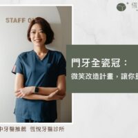 門牙全瓷冠：微笑改造計畫，讓你重拾自信