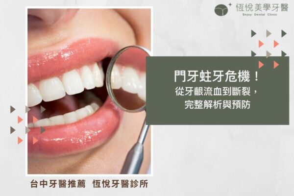 門牙蛀牙危機！ 從牙齦流血到斷裂， 完整解析與預防