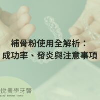 full-analysis-of-bone-powder-usage