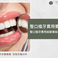 整口植牙費用要多少？整口植牙費用細節算給你看