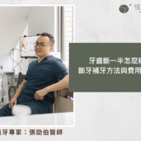牙齒斷一半怎麼辦？ 斷牙補牙方法與費用全解析