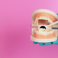 hands-is-hold-orthodontic-model-of-teeth-and-denta-2023-01-04-02-36-22-utc (1)