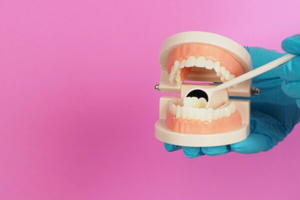 hands-is-hold-orthodontic-model-of-teeth-and-denta-2023-01-04-02-36-22-utc (1)
