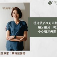 植牙後多久可以抽菸？植牙抽菸、喝酒小心植牙失敗！