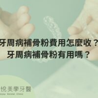 how-much-does-bone-powder-for-periodontal-disease-cost