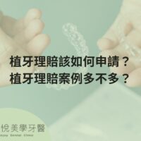 how-to-apply-for-dental-implant-claims
