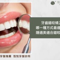 牙齒錯咬矯正哪一種方式最適合？隱適美適合錯咬嗎？