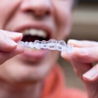 man-holds-put-on-invisible-braces-invisalign-plas-2022-11-15-14-04-40-utc (1)