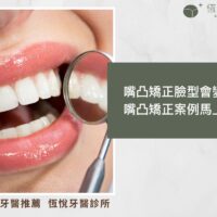 嘴凸矯正臉型會變嗎？嘴凸矯正案例馬上看！