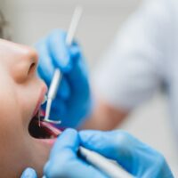 Operating Teeth Filling Mouth Cavity Against Cari Utc