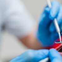 operating-teeth-tooth-filling-mouth-cavity-agains-2021-12-09-04-31-32-utc (1)