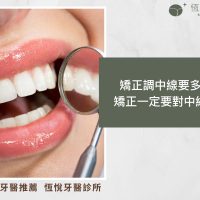 矯正調中線要多久？矯正一定要對中線嗎？