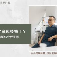 做完全瓷冠後悔了？專業醫師幫你分析原因